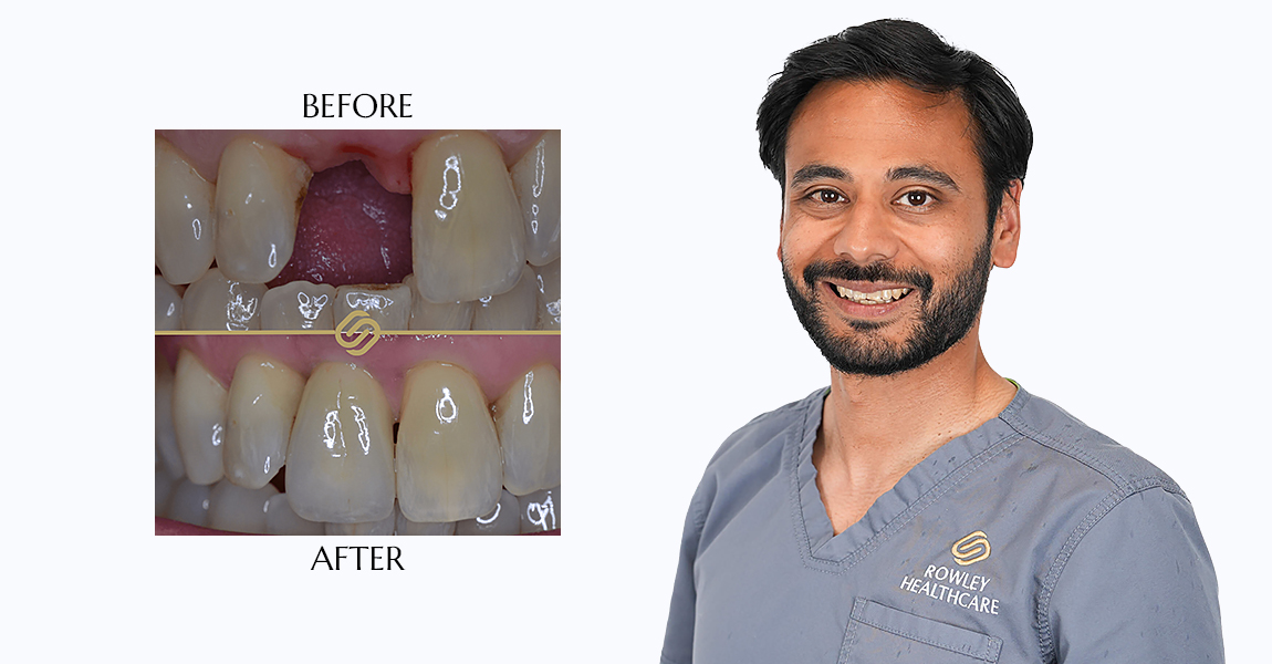 Dental Implant Open Day