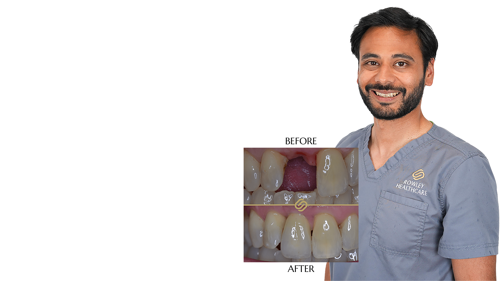 Dental Implant Open Day