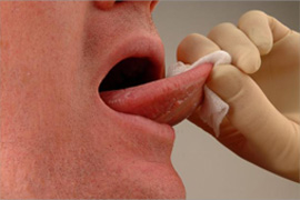 Mouth cancer soft tissue exam